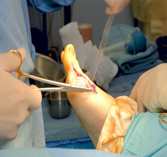 Foot and Ankle Surgery